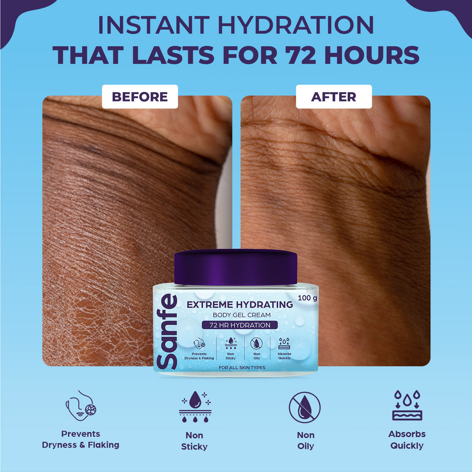 Sanfe Extreme Hydrating Body Gel Cream