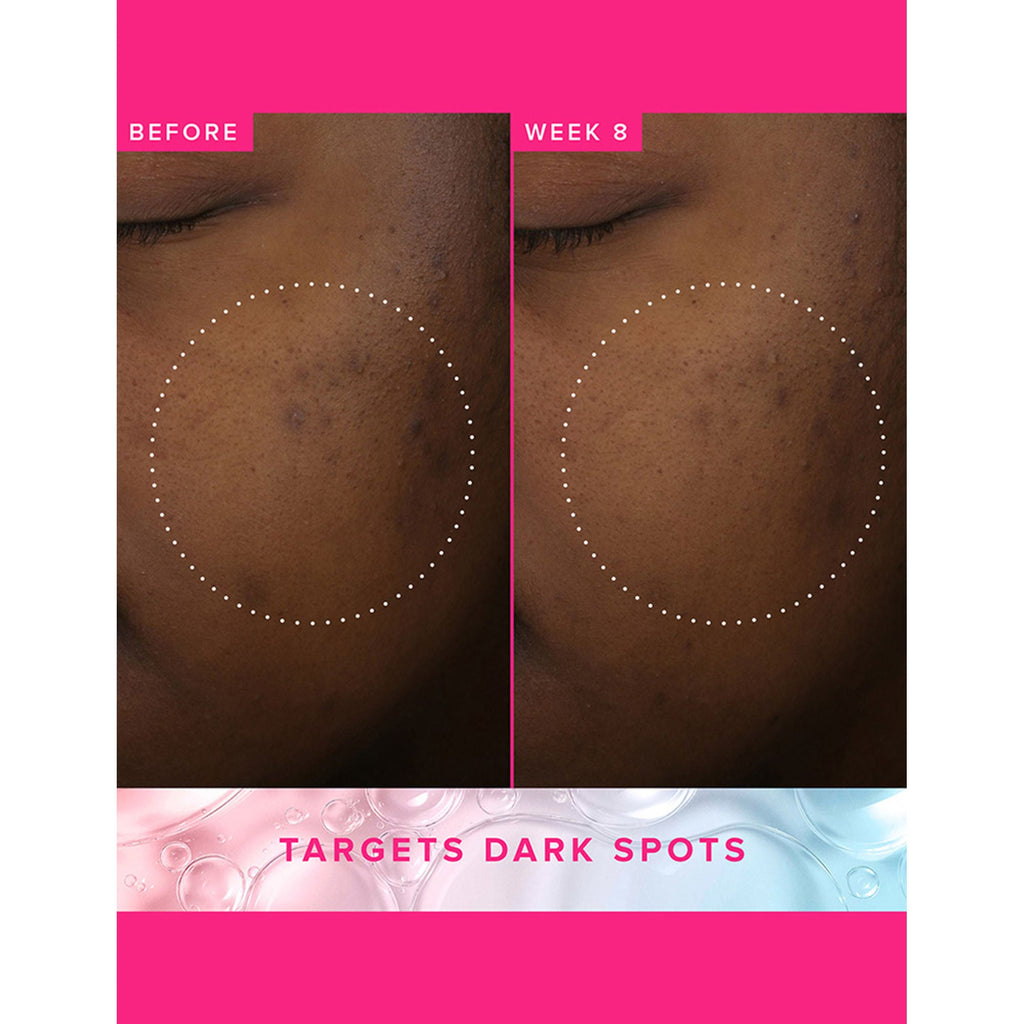 Farmacy Beauty Brighten Up 3% TXA Dark Spot Toner