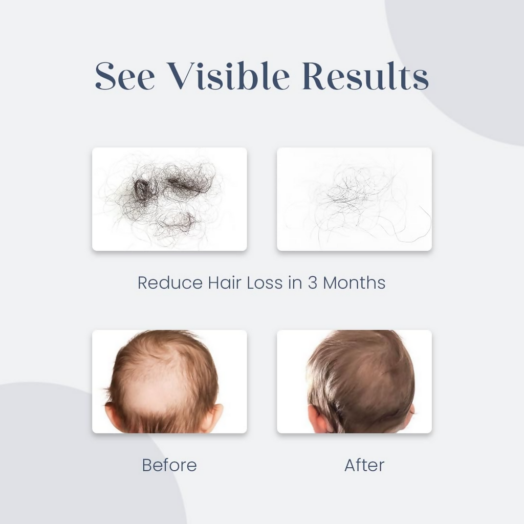 O'Mumsie Baby Hair Growth & Scalp Care Oil