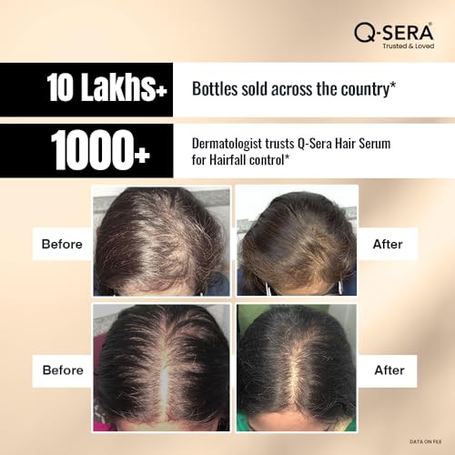 QSERA Hair Serum for Hair Fall Control