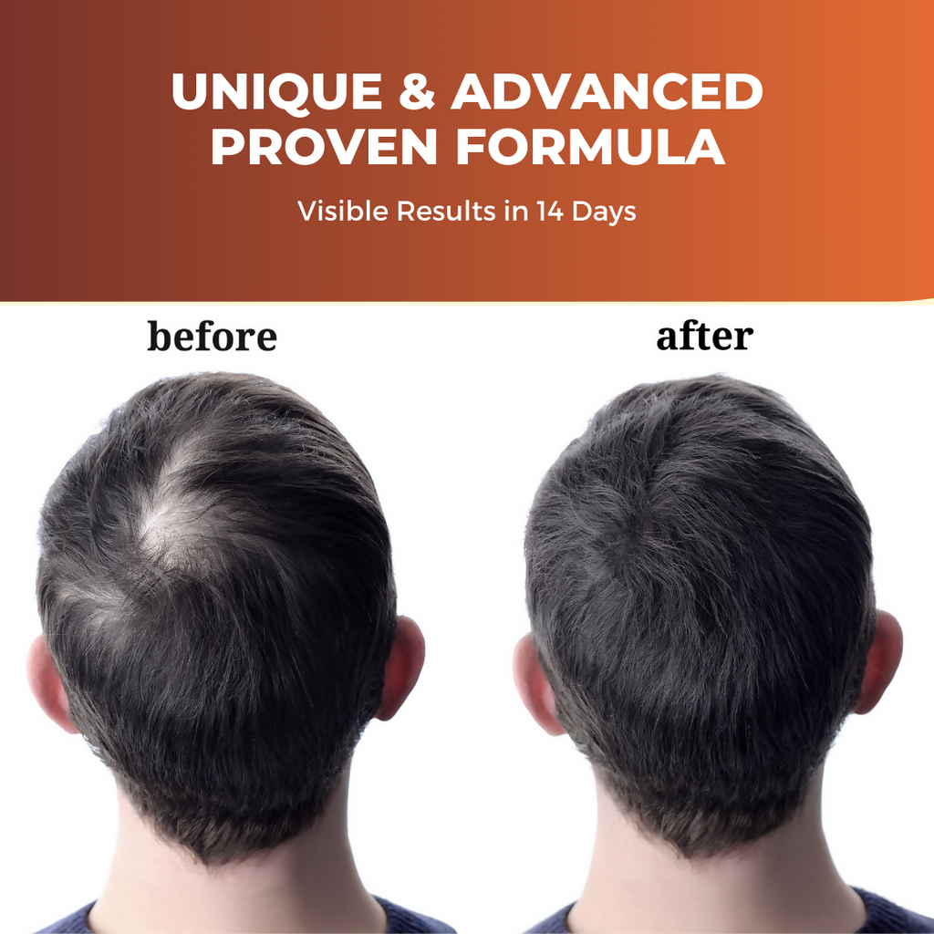 Prisa Organics Hair Re Growth Serum