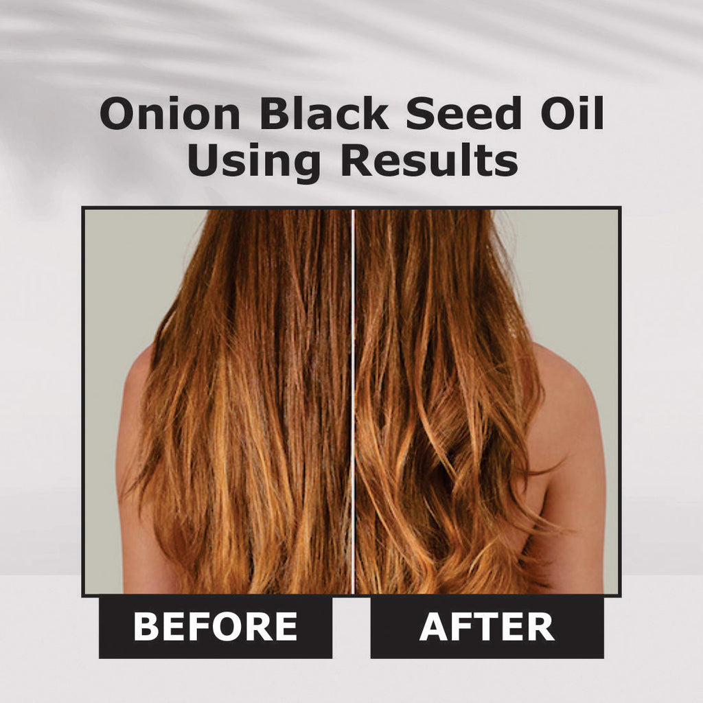 Nuerma Science Onion Black Seed Hair Oil
