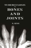 Tuberculosis of Bones and Joints - Gyan Books