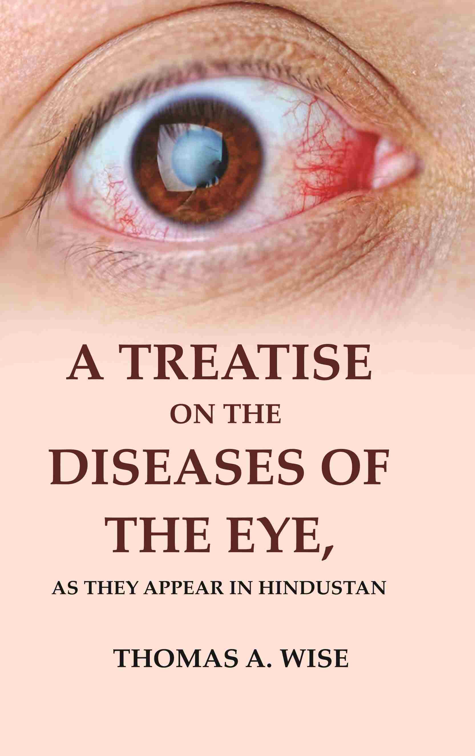 A Treatise on the Diseases of The Eye: As they appear in Hindustan - Gyan Books