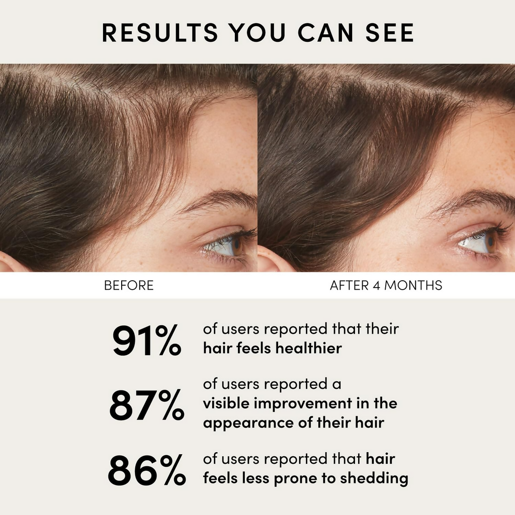 Ouai Scalp Serum