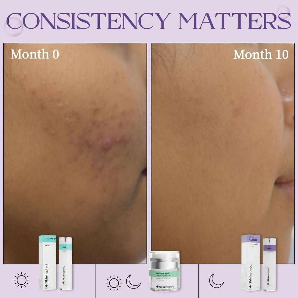SkinInspired Retinol Face Serum (2% vitAlease)