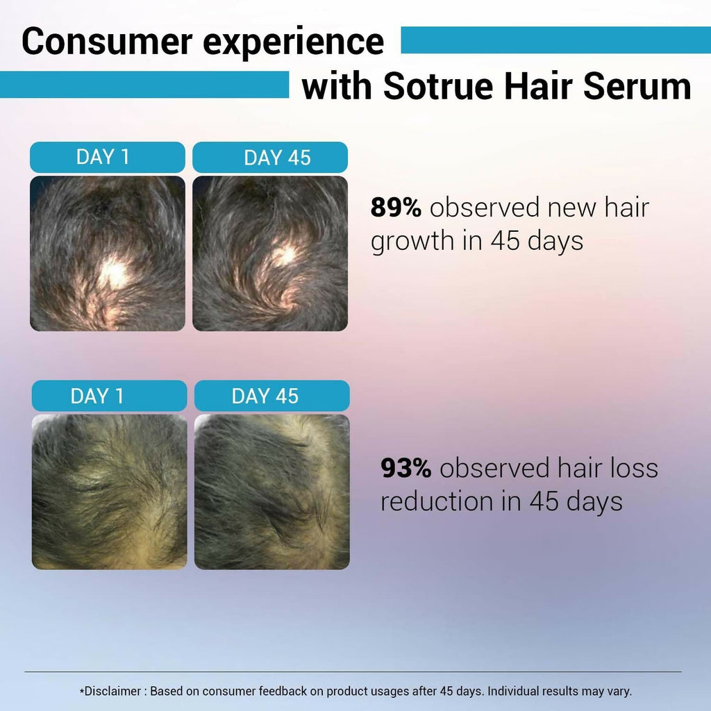 Sotrue Hair Growth Serum With Redensyl 3%, Procapil 3%, Anagain 4% and Baicapil 2% Hair Growth Actives