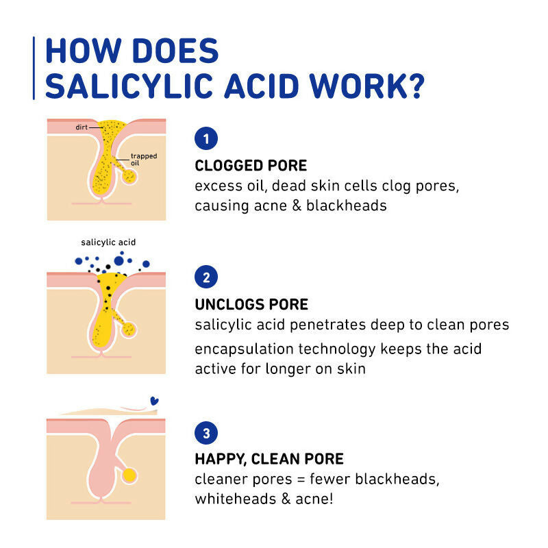 Plum Salicylic & Lactic Acid Skin-Smoothing Gel Moisturizer - For Active Acne & Oil-Free Hydration