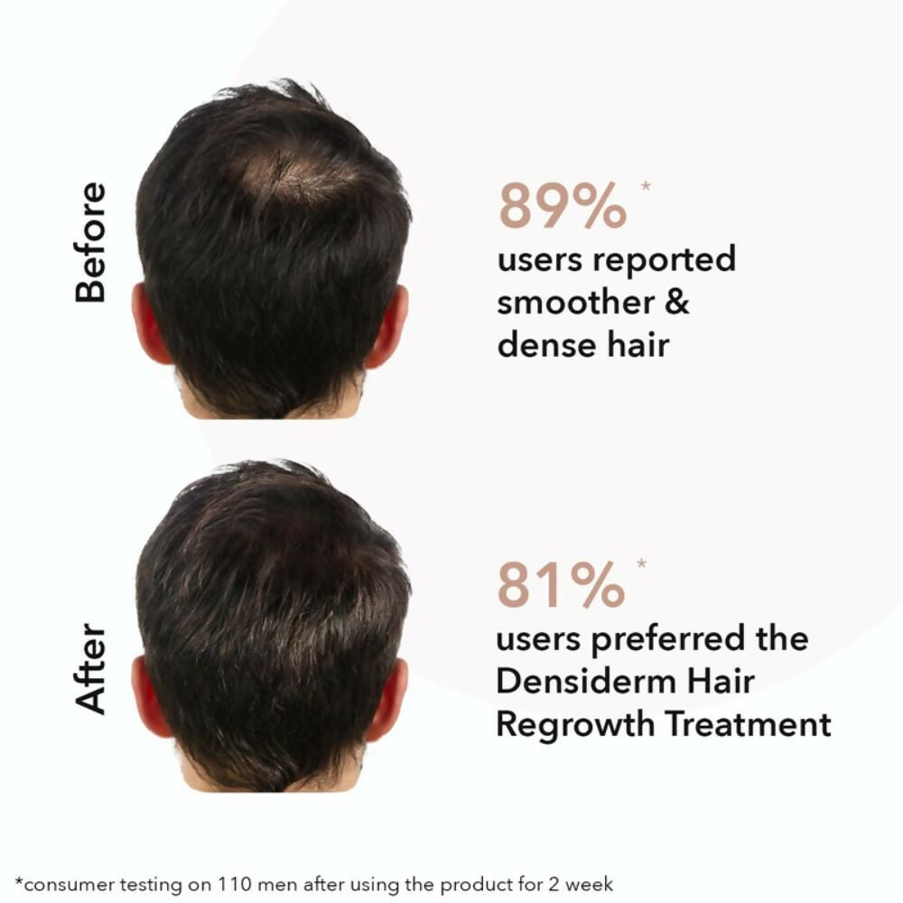 Professional O3+ Men Densiderm Hair Growth Scalp Serum Spray For Anti Hair Loss With Ginseng