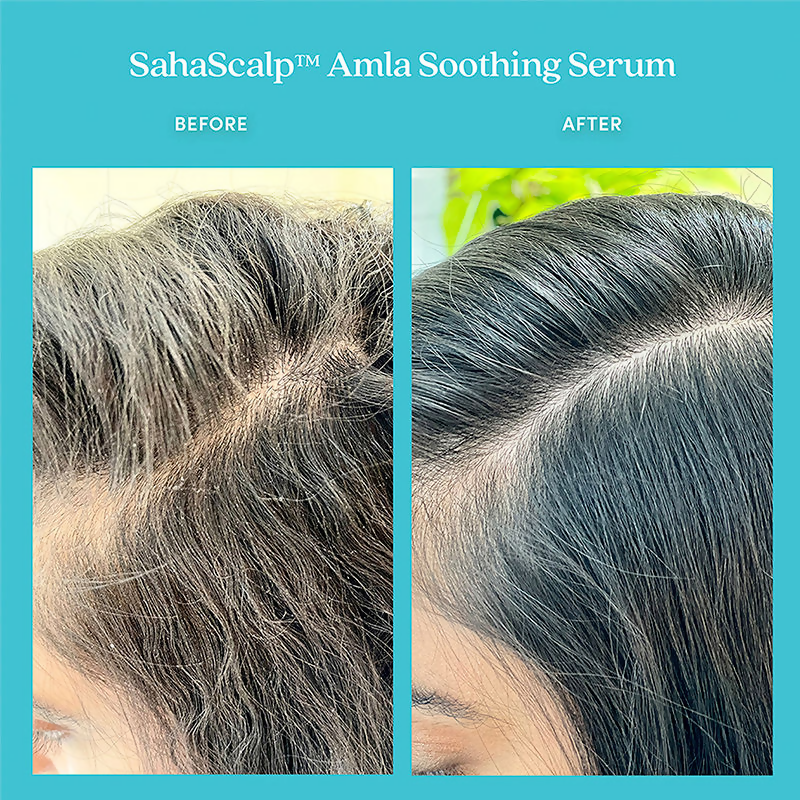 Fable & Mane Sahascalp Amla Soothing Hair Serum For Dry And Sensitive Scalp