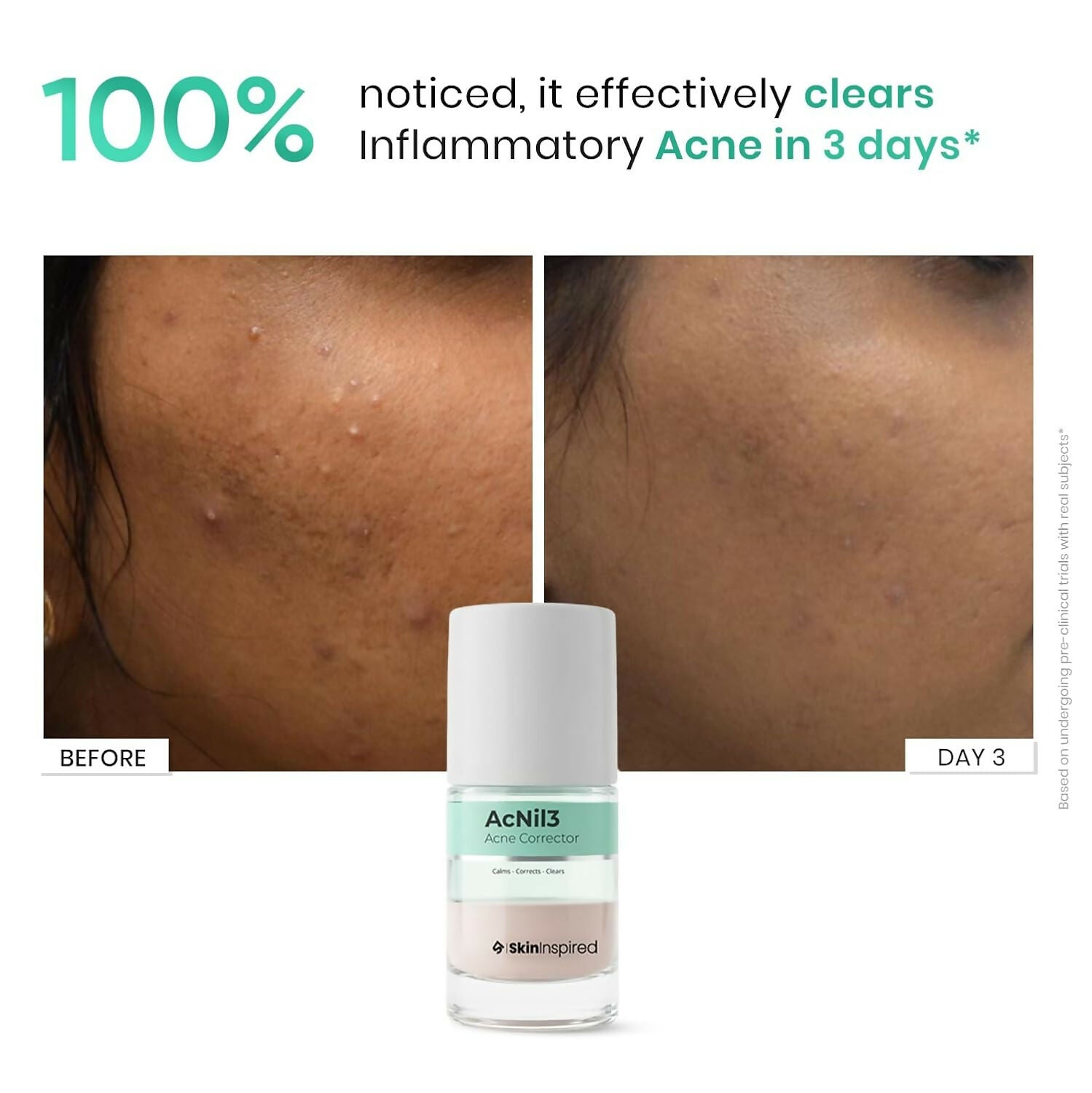 SkinInspired AcNil3 Rapid Spot Corrector