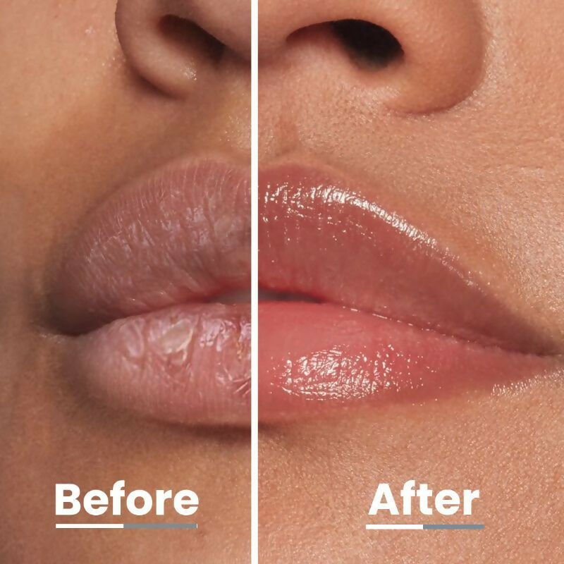 Hyphen By Kriti Sanon Juicy Lips Or Nothing Lip Care Combo For Dry & Chapped Lips, Hydrates & Moisturizes